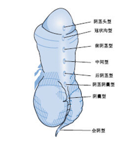 冠状沟什么位置