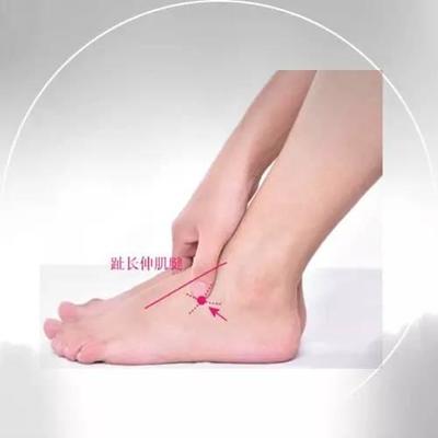 趾长伸肌疼用什么药