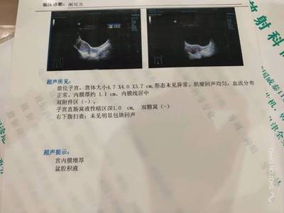 阑尾炎看什么科