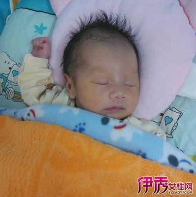 婴儿做ct检查什么影响