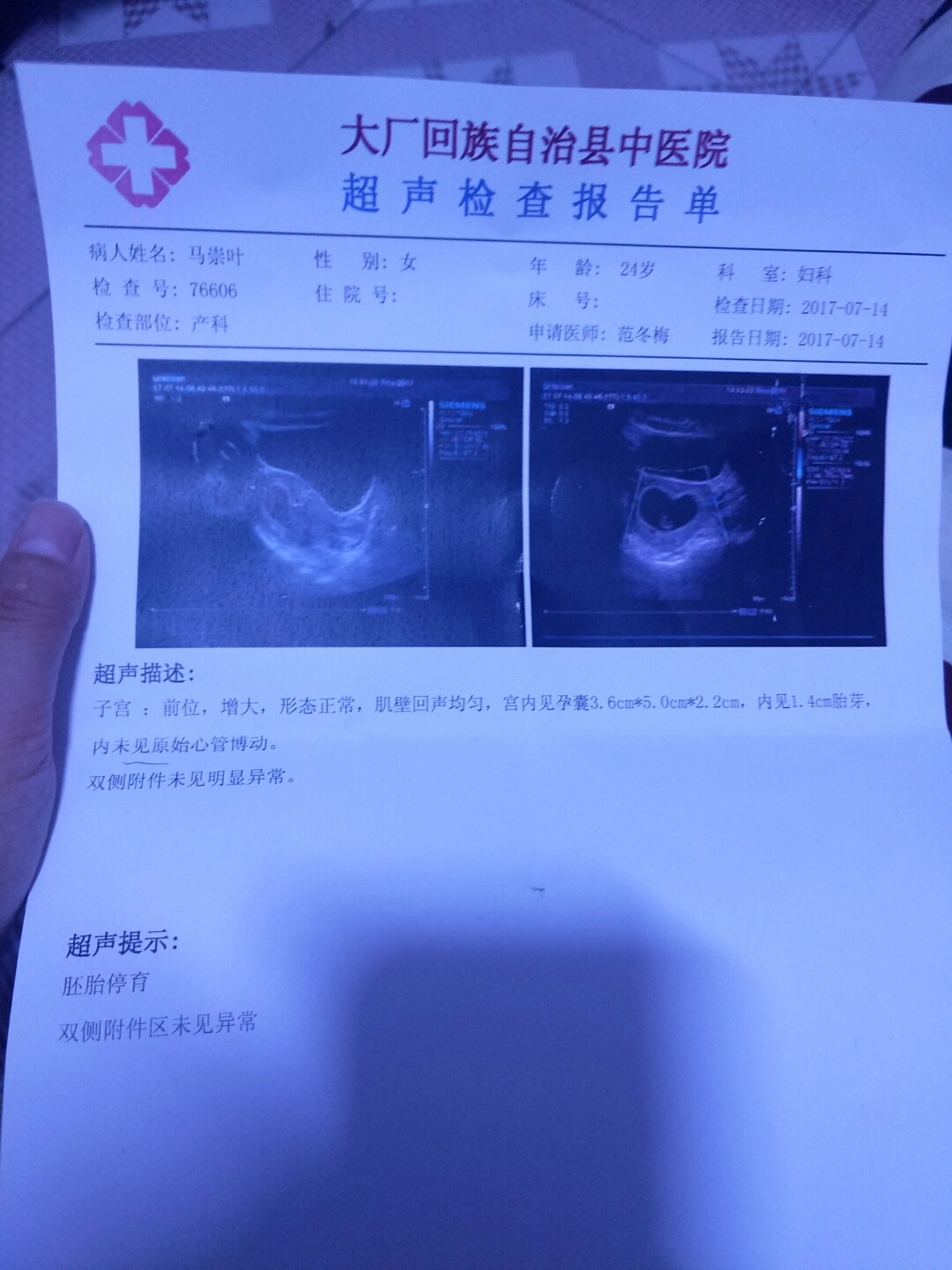 如果怀孕b超显示什么问题