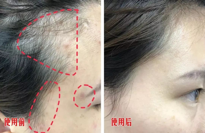 为什么脸油头油这么快