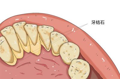 嘴巴恶臭是什么原因