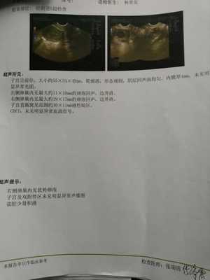 经期过后吃什么促排卵