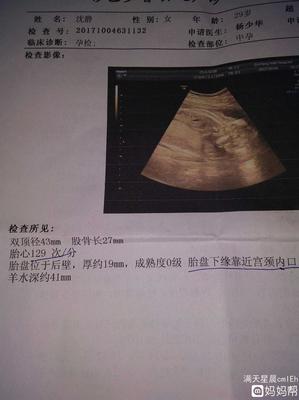 5个月的胎心在什么位置