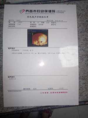 胎块是什么