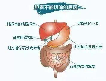 肝疼和胆囊结石疼有什么区别