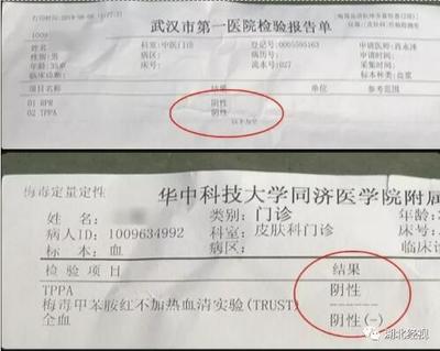 婚检梅毒1 1什么意思