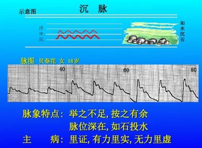 脉象沉缓是什么意思