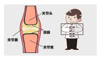有时候骨头为什么会响