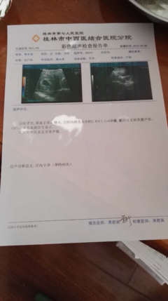 胎芽小是什么原因造成的