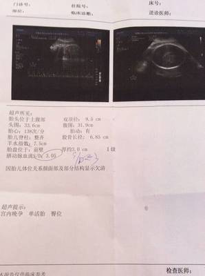 孕36周吸氧注意什么