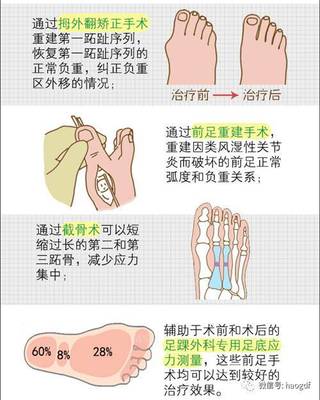 脚垫病图有什么症状