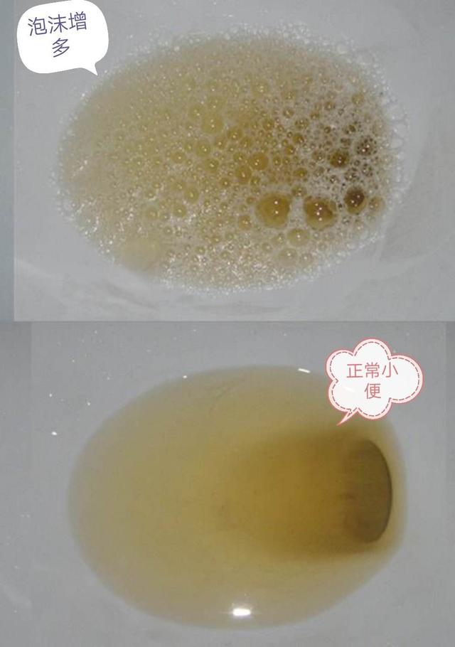 尿好黄是什么原因