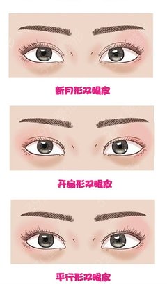 便双眼皮的方法是什么意思