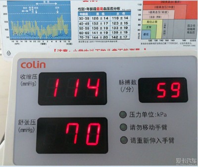血压50-90是什么情况