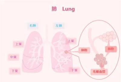什么是空洞肺结核