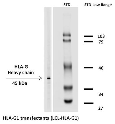 hla-27 有什么用