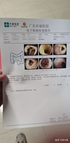 肠镜检查前喝什么意思