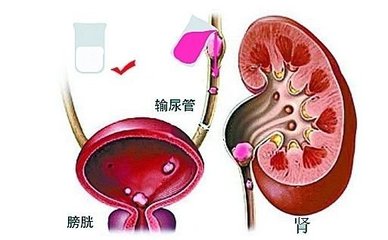 膀胱结石可以吃什么菜