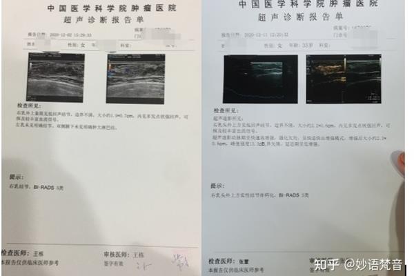 乳腺钼靶检查为什么疼