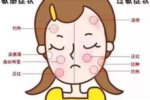 皮肤薄用什么水