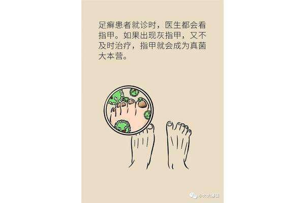 为什么脚气好不了