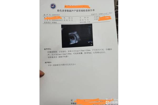 孕185天做什么检查
