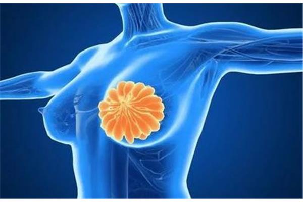 乳房扫描是检查什么的
