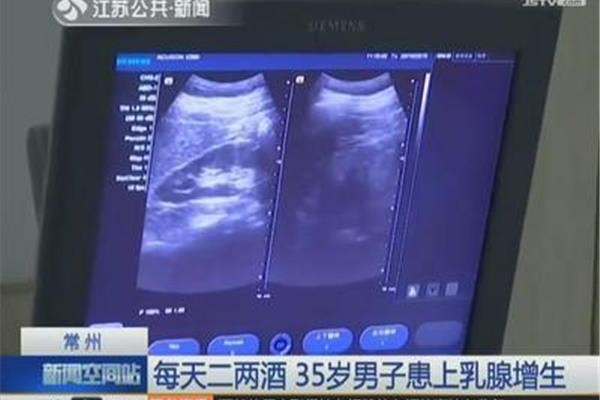 乳房扫描是检查什么的