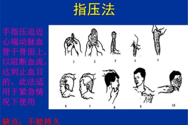 指压法止血用什么指