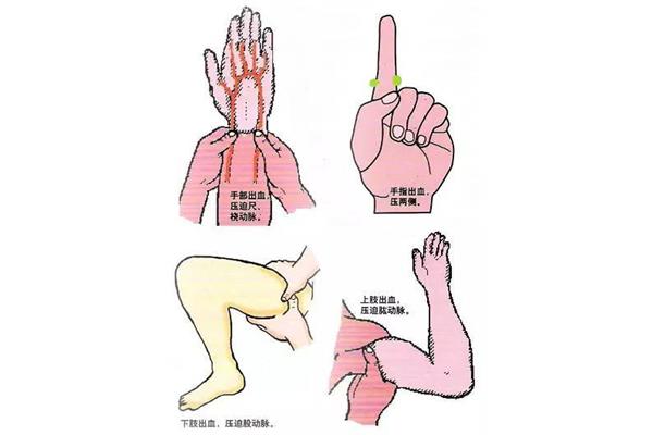 指压法止血用什么指