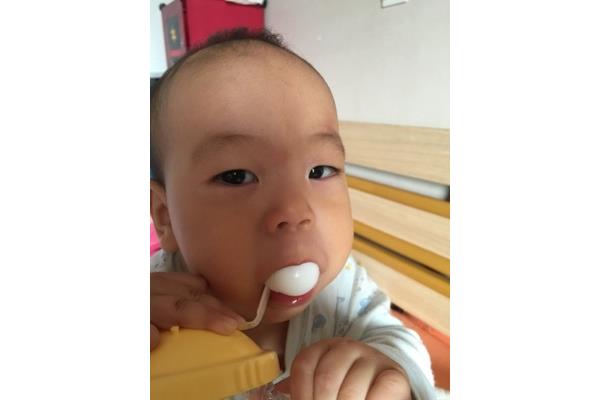 婴儿泪腺为什么不通