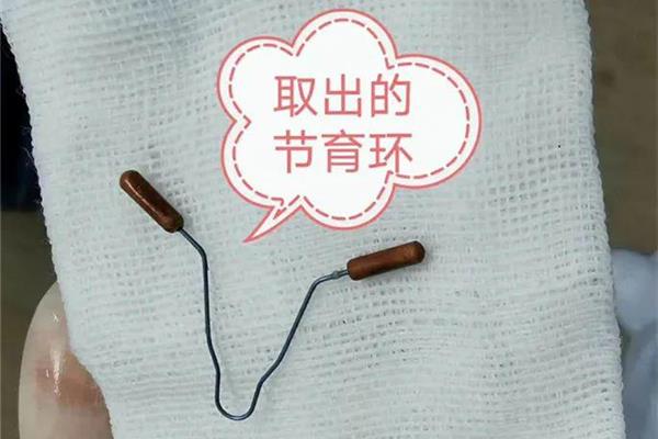 环为什么会长肉里面