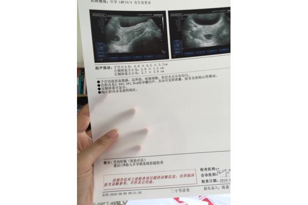 做阴式b超对身体有什么不好
