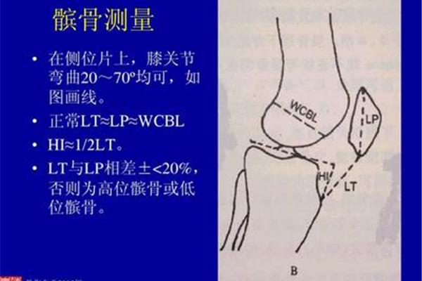 膝盖c?B检查什么意思